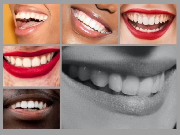 Why you need a dental hygienist. Maintaining beautiful smiles and a key part of the dental team.