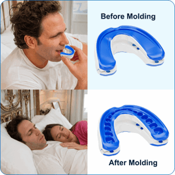 VitalSleep Anti Snoring Mouthpiece